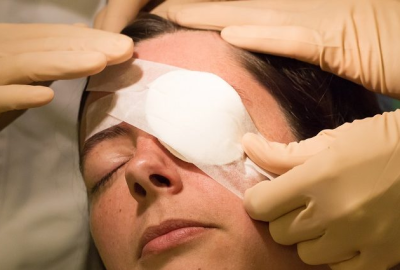 CATARACT